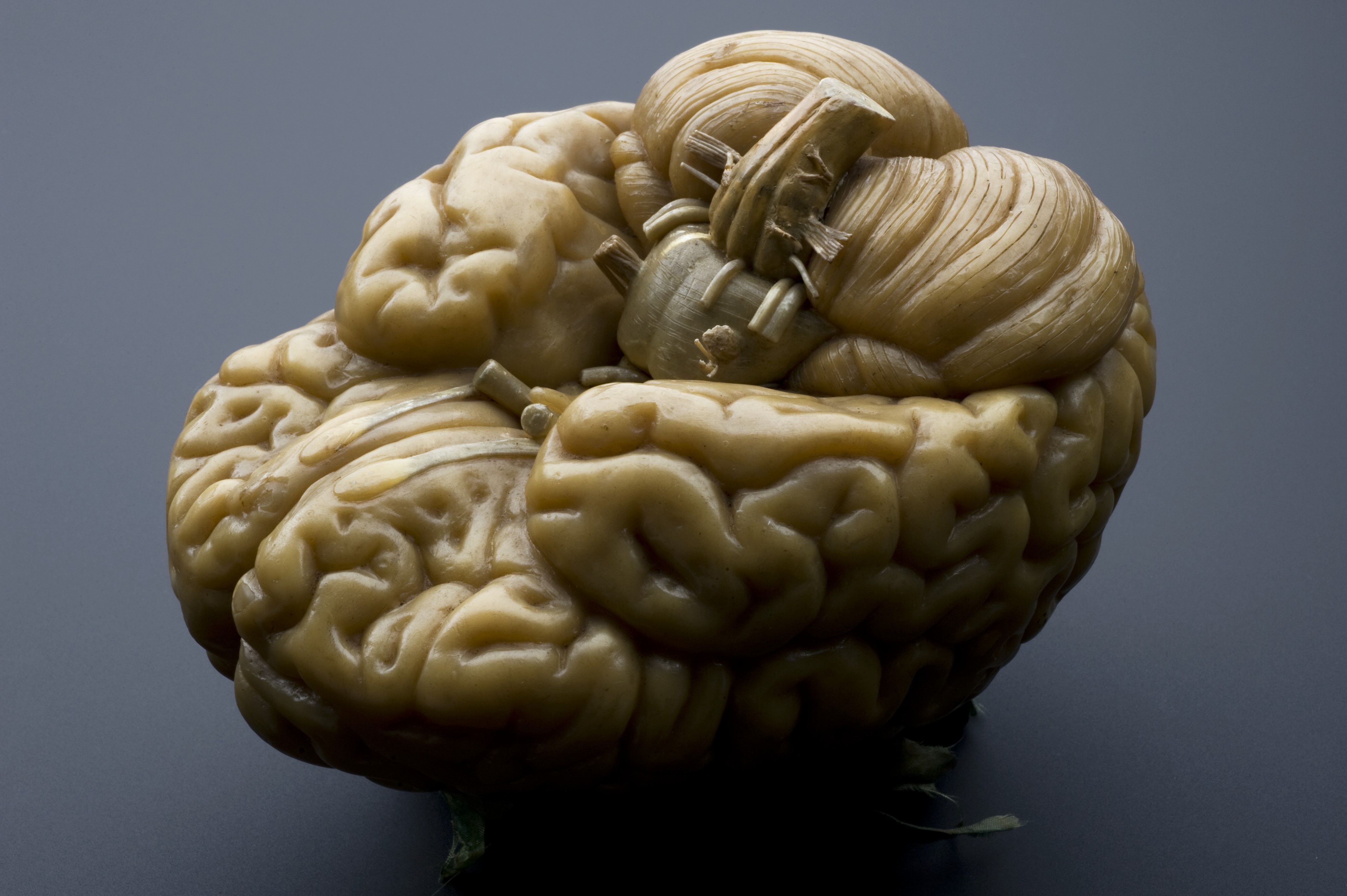 Видео про мозги. Красивый мозг.
